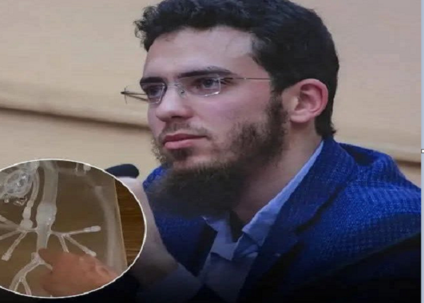 طبيب مغربي يعلن عن اختراع طبي غير مسبوق لتصفية الدم ومنع رفض زراعة الأعضاء